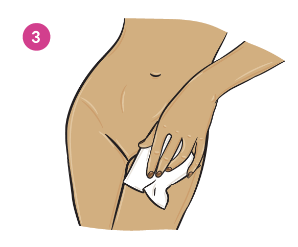 Gently wipe the outer genital area. </br>
Spread the labia (lips) apart and wipe around the folds to remove any dirt, debris or discharge. </br>
After wiping the vulva, wipe the area between the vulva and the anus. </br>
Always wipe from front to back </br>(vulva first, anus last).
